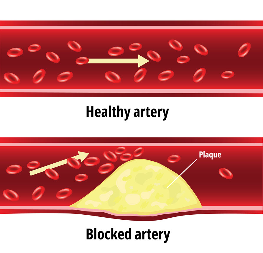 Cholesterol | True Vine Organics